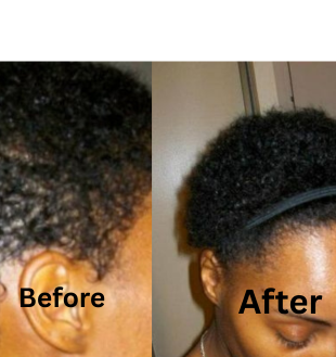 Batana Hair growth Oil. Healthy scalp, promoting hair growth. 3.4OZ