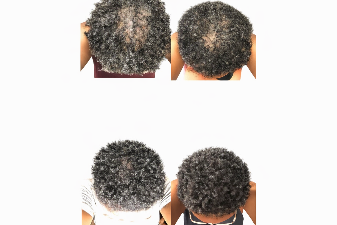 Batana Hair growth Oil. Healthy scalp, promoting hair growth. 3.4OZ