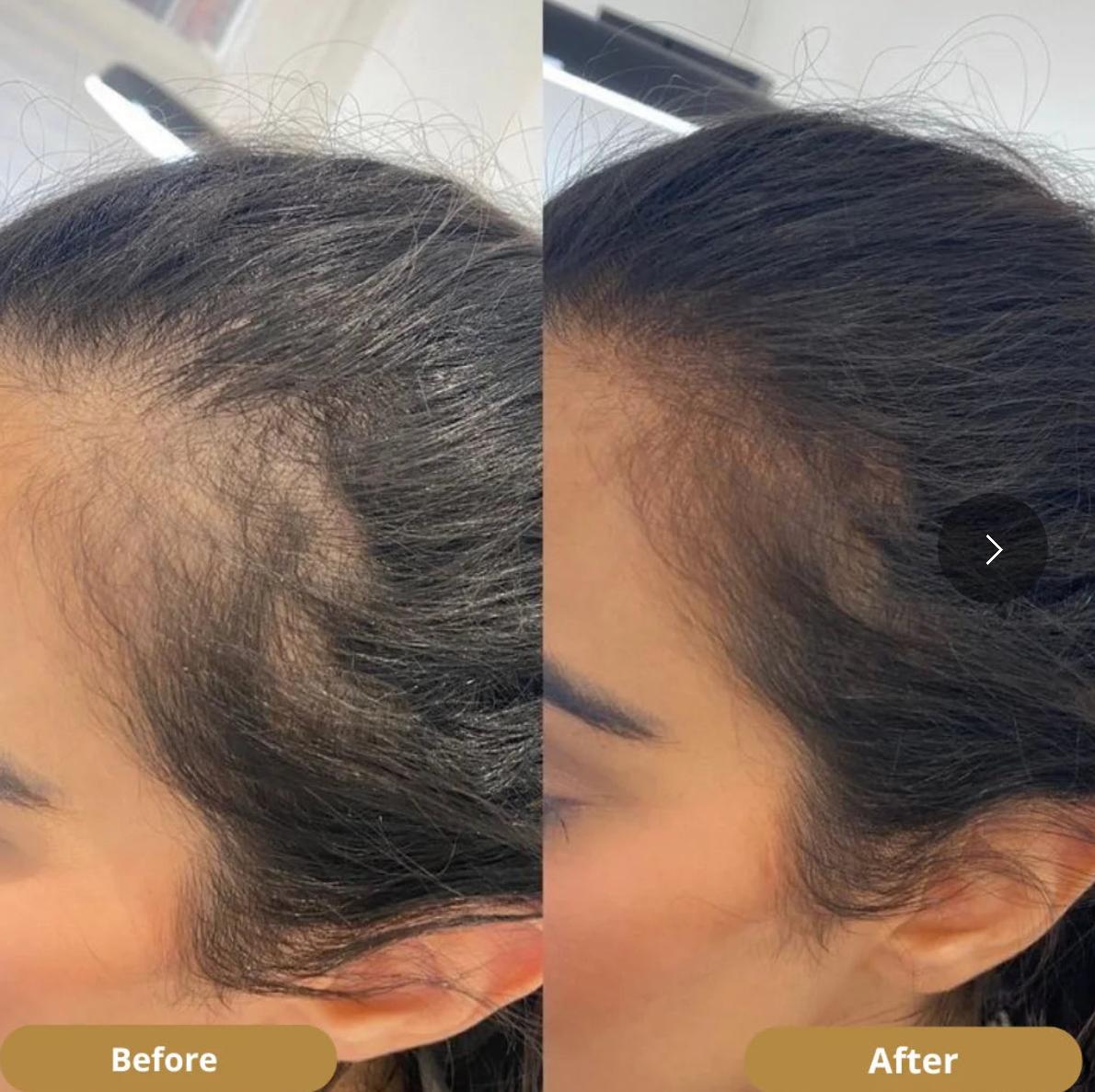 Batana Hair growth Oil. Healthy scalp, promoting hair growth. 3.4OZ