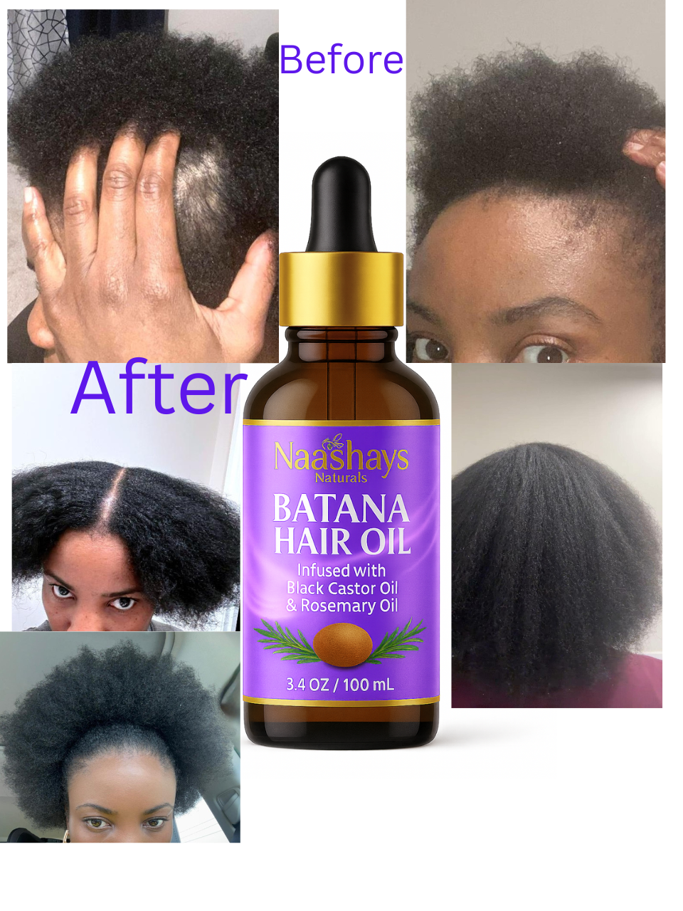 Batana Hair growth Oil. Healthy scalp, promoting hair growth. 3.4OZ